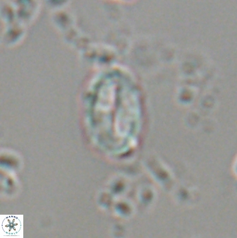 Neocrepidolithus neocrassus 22972