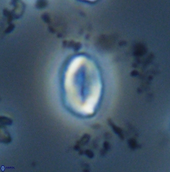 Neocrepidolithus neocrassus 22973