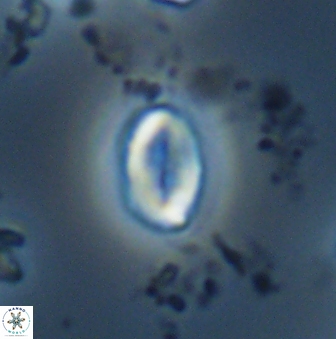 Neocrepidolithus neocrassus 22973