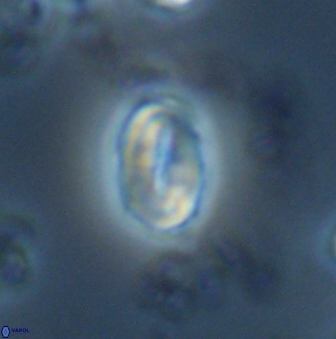 Neocrepidolithus neocrassus 22974