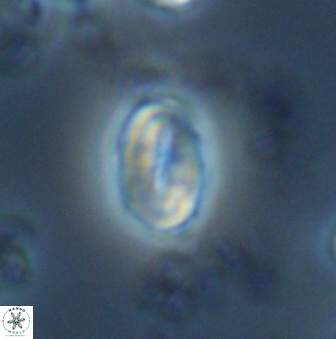 Neocrepidolithus neocrassus 22974