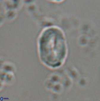 Neocrepidolithus neocrassus 22975