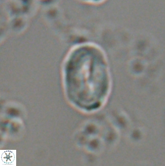 Neocrepidolithus neocrassus 22975