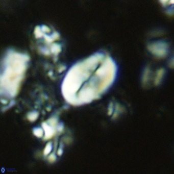 Neocrepidolithus neocrassus VR 10004