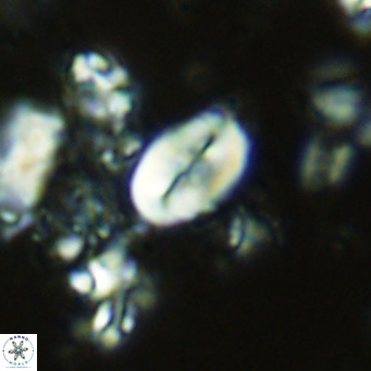 Neocrepidolithus neocrassus VR 10004