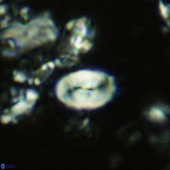 Neocrepidolithus neocrassus VR 10005