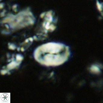 Neocrepidolithus neocrassus VR 10005