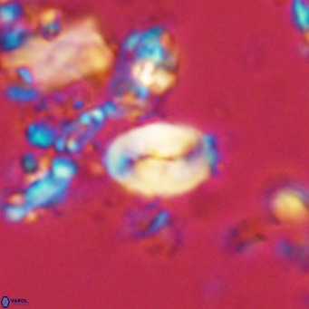 Neocrepidolithus neocrassus VR 10006