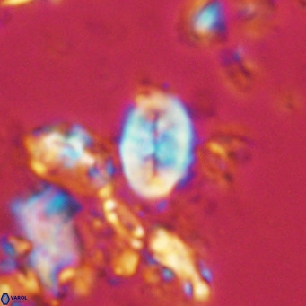 Neocrepidolithus neocrassus VR 10007