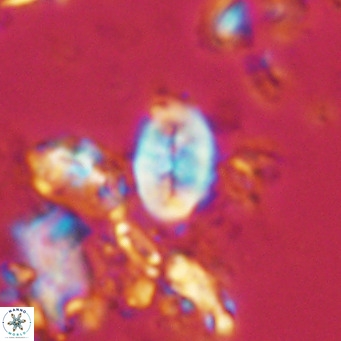 Neocrepidolithus neocrassus VR 10007
