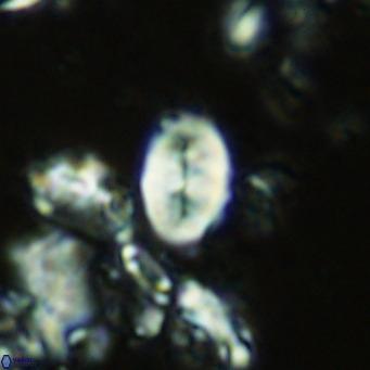 Neocrepidolithus neocrassus VR 10009