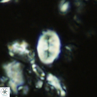Neocrepidolithus neocrassus VR 10009