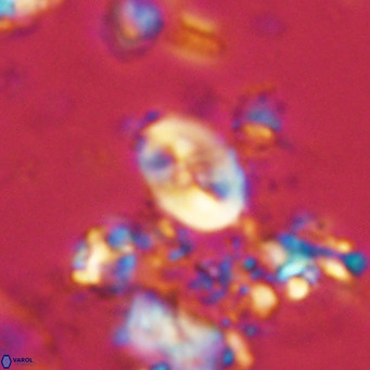 Neocrepidolithus neocrassus VR 10011