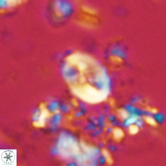 Neocrepidolithus neocrassus VR 10011