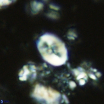 Neocrepidolithus neocrassus VR 10013