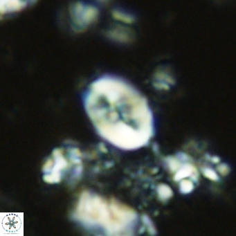 Neocrepidolithus neocrassus VR 10013