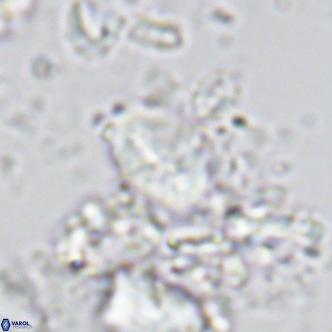 Neocrepidolithus neocrassus VR 10018