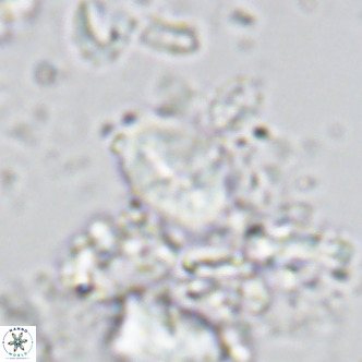 Neocrepidolithus neocrassus VR 10018