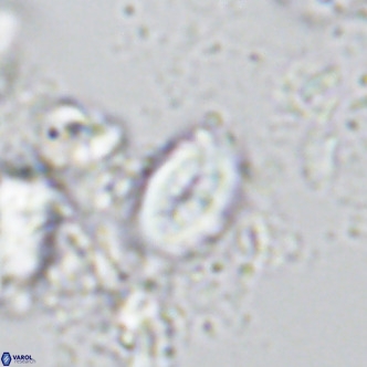 Neocrepidolithus neocrassus VR 10024