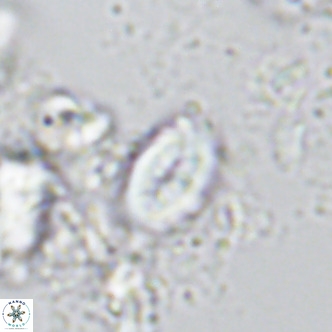 Neocrepidolithus neocrassus VR 10024
