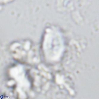 Neocrepidolithus neocrassus VR 10026