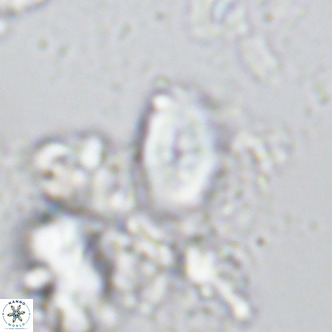 Neocrepidolithus neocrassus VR 10026