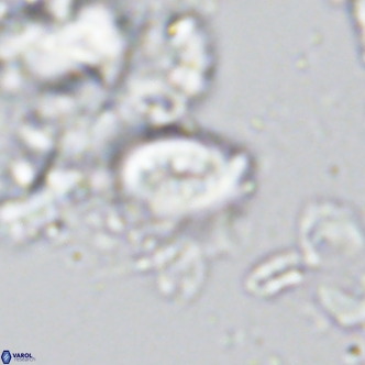 Neocrepidolithus neocrassus VR 10029