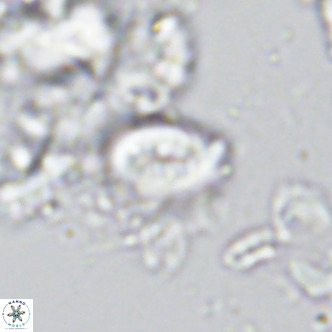 Neocrepidolithus neocrassus VR 10029