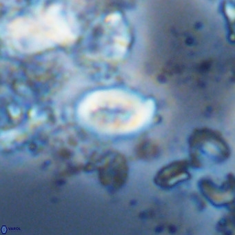 Neocrepidolithus neocrassus VR 10030