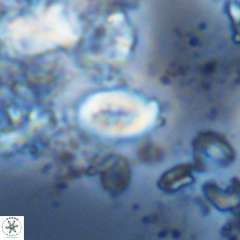 Neocrepidolithus neocrassus VR 10030
