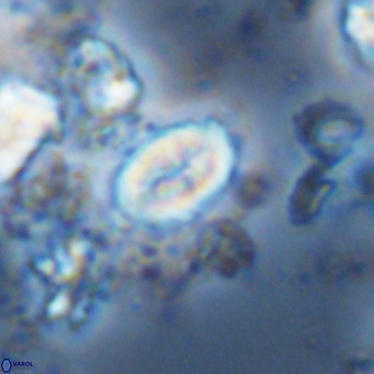 Neocrepidolithus neocrassus VR 10031