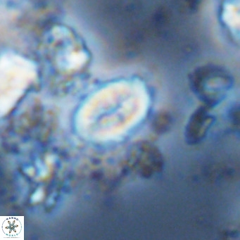 Neocrepidolithus neocrassus VR 10031