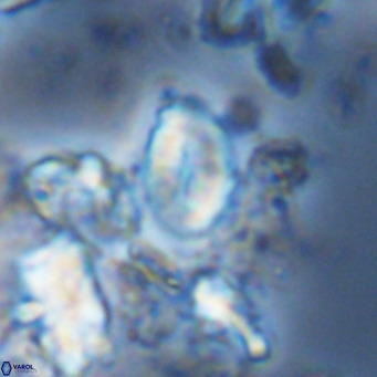 Neocrepidolithus neocrassus VR 10032
