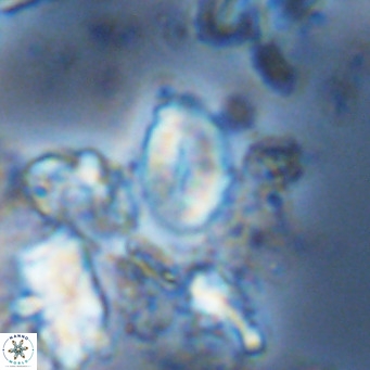 Neocrepidolithus neocrassus VR 10032