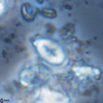 Neocrepidolithus neocrassus VR 10033