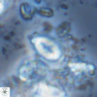 Neocrepidolithus neocrassus VR 10033