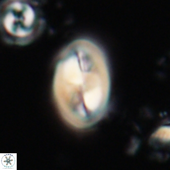 Neocrepidolithus opertus 21484