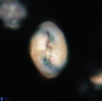 Neocrepidolithus opertus 21485