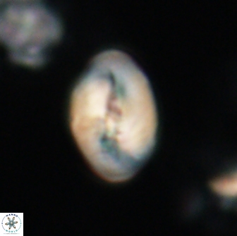 Neocrepidolithus opertus 21485
