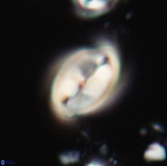 Neocrepidolithus opertus 21488