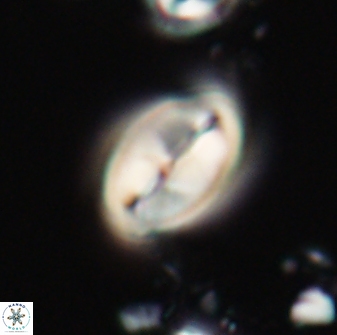 Neocrepidolithus opertus 21488