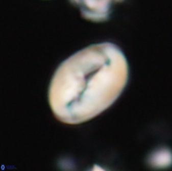 Neocrepidolithus opertus 21489