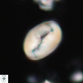 Neocrepidolithus opertus 21489
