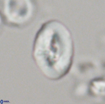 Neocrepidolithus opertus 21491