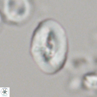 Neocrepidolithus opertus 21491