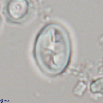 Neocrepidolithus opertus 21492