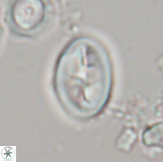 Neocrepidolithus opertus 21492
