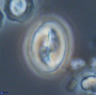 Neocrepidolithus opertus 21494