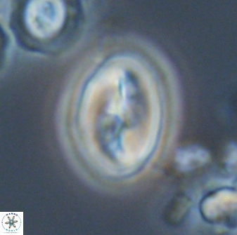 Neocrepidolithus opertus 21494