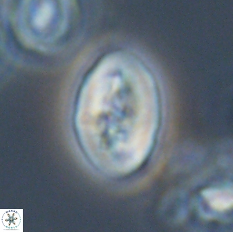 Neocrepidolithus opertus 21495